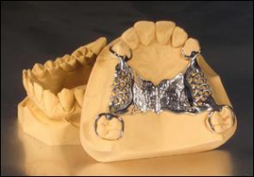 SHERAPRIMA 5 kg
